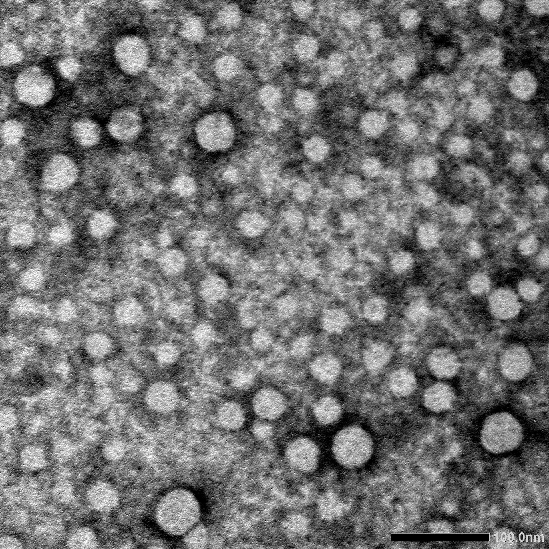 Representative TEM microscopy